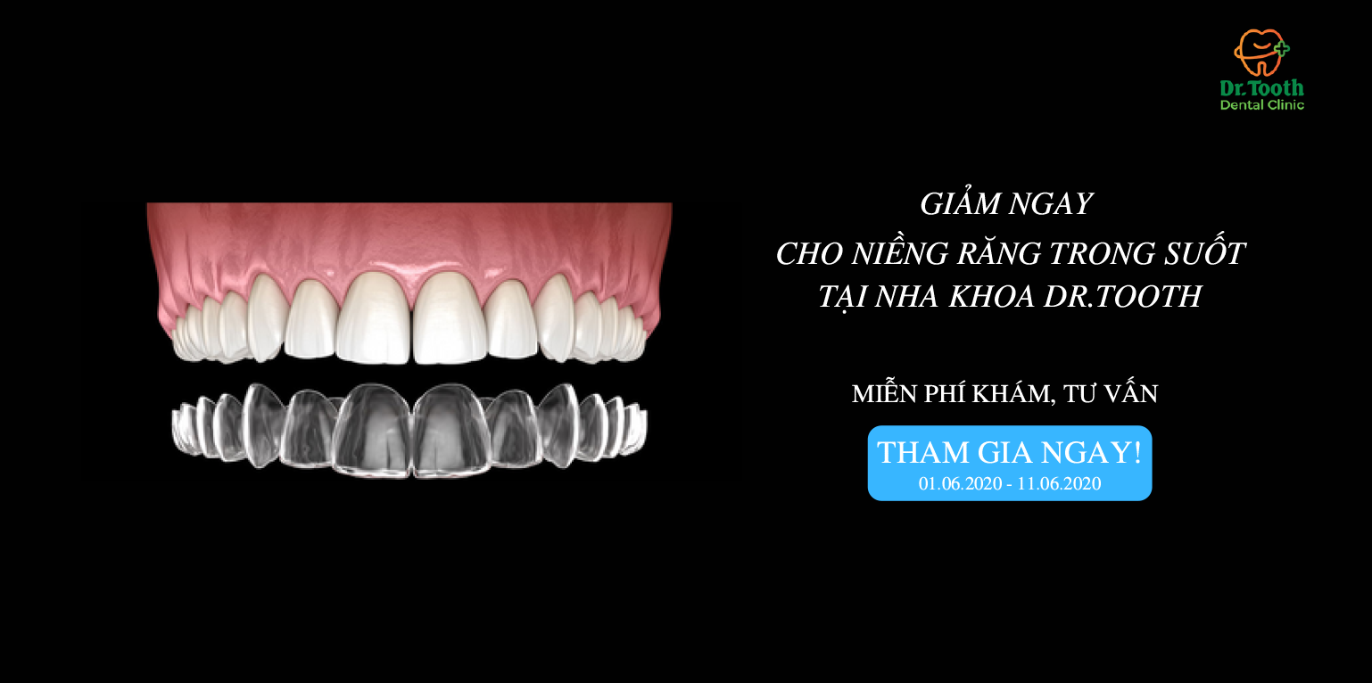 Ưu điểm của khay chỉnh nha Invisalign so với mắc cài