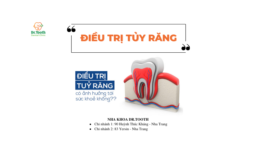 Điều trị tủy không thành công
