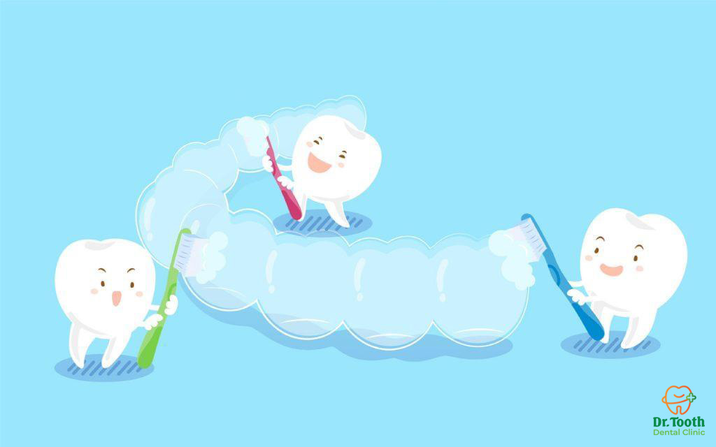 bao-quan-khay-invisalign-a