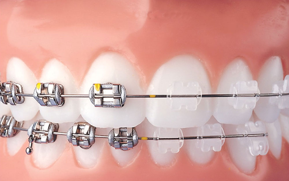 fixed_ortho_course